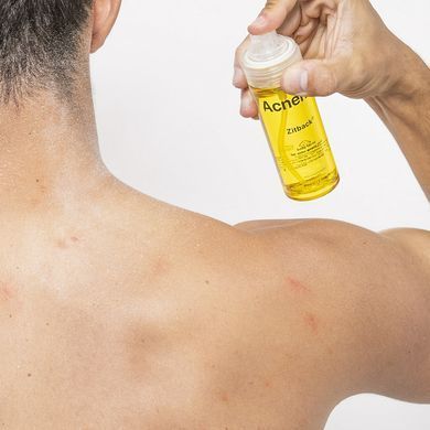 Спрей для тіла проти акне Acnemy Zitback Body Spray For Blemish-Prone Skin 80 мл - основне фото