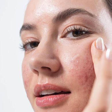 Успокаивающий флюид против несовершенств кожи с бакучиолом Erborian Centella Acne Care Soothing Fluid 30 мл - основное фото